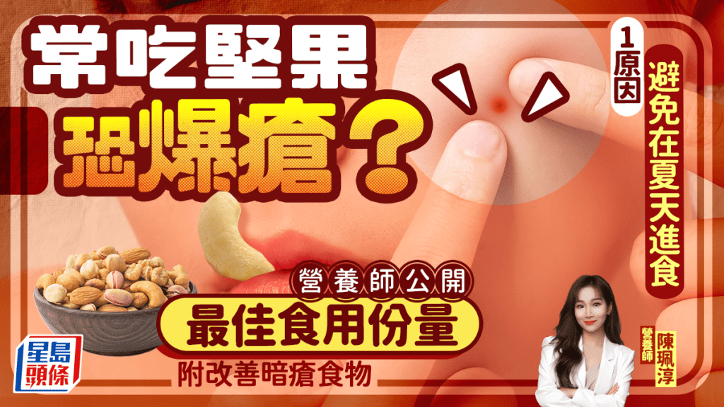 常吃堅果恐爆瘡?營養師公開最佳食用份量 1原因避免在夏天進食