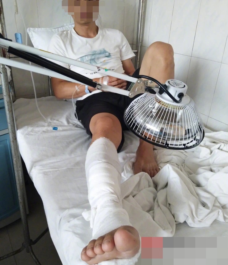 男子被菜刀砍傷右小腿,右脛前肌腱斷裂。網圖