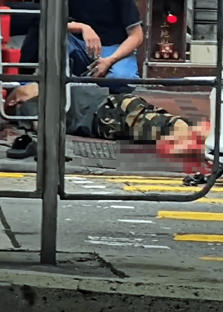男傷者雙腳重創。網圖