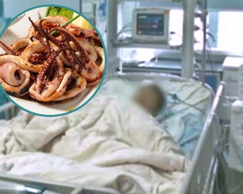 男童進食變質的魷魚引發「溶血尿毒綜合症」。網圖