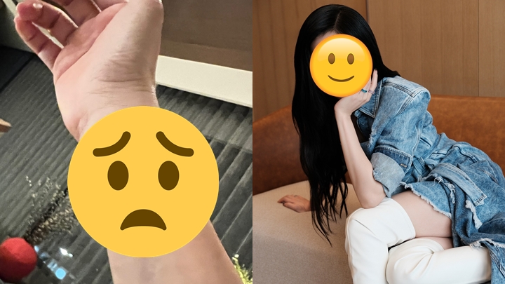 46歲女星視后做運動「爆靜脈血管」！  傷勢曝光網民紛紛勸做一事