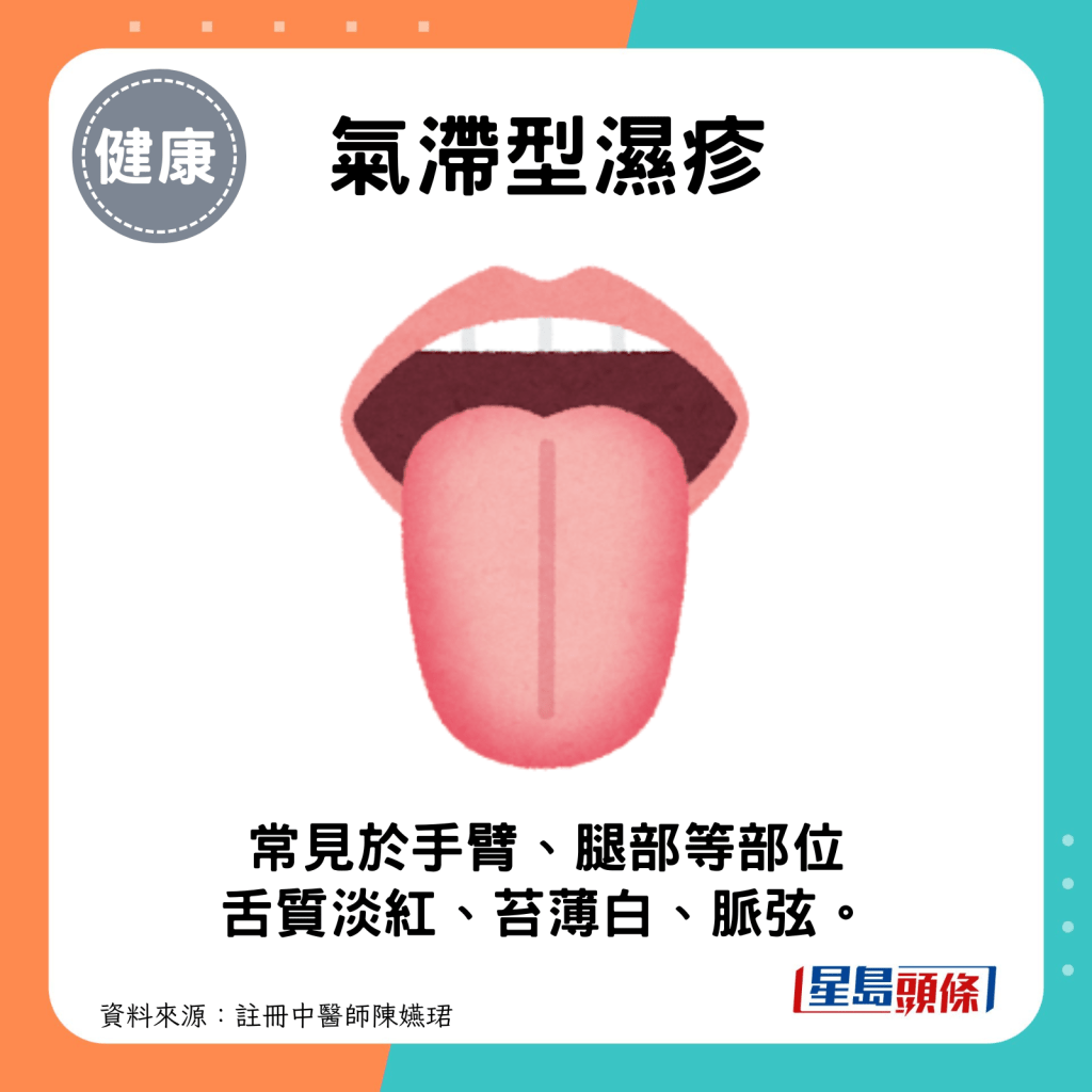 氣滯型濕疹：舌質淡紅，苔薄白，脈弦。