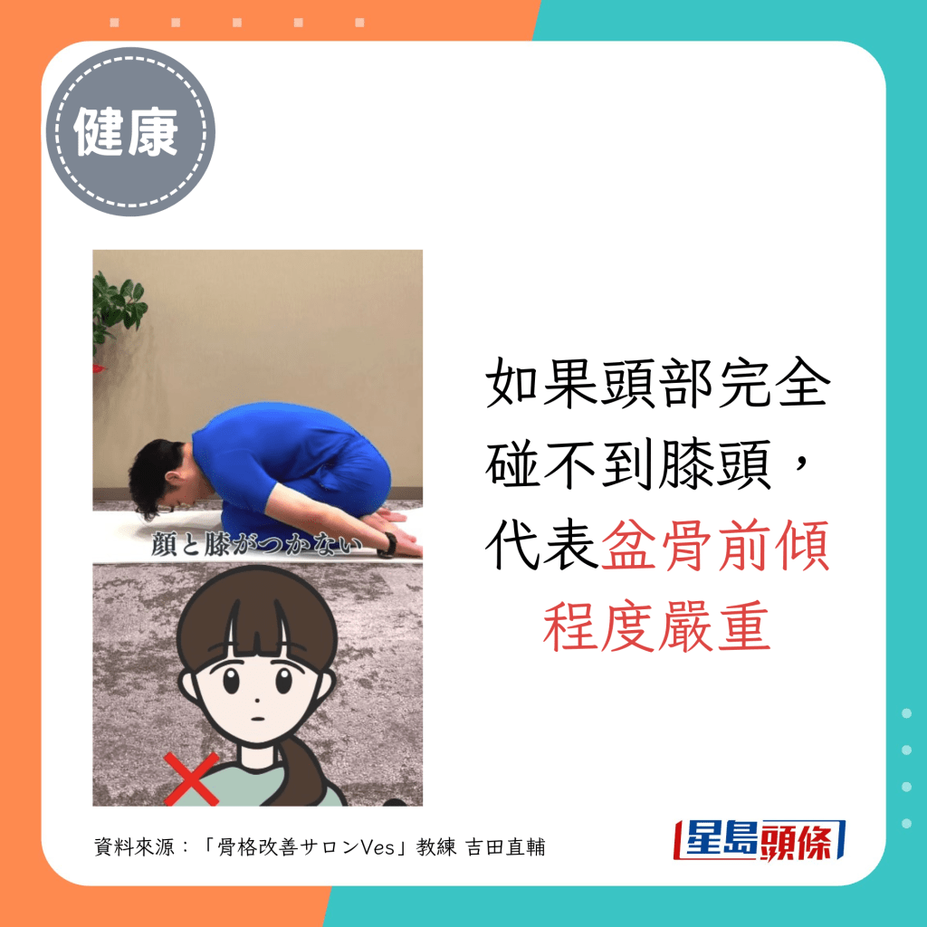 如果頭部完全碰不到膝頭，代表盆骨前傾程度嚴重