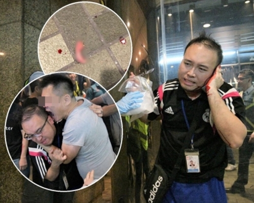 林卓廷指趙家賢已做手術駁回耳朵。資料圖片