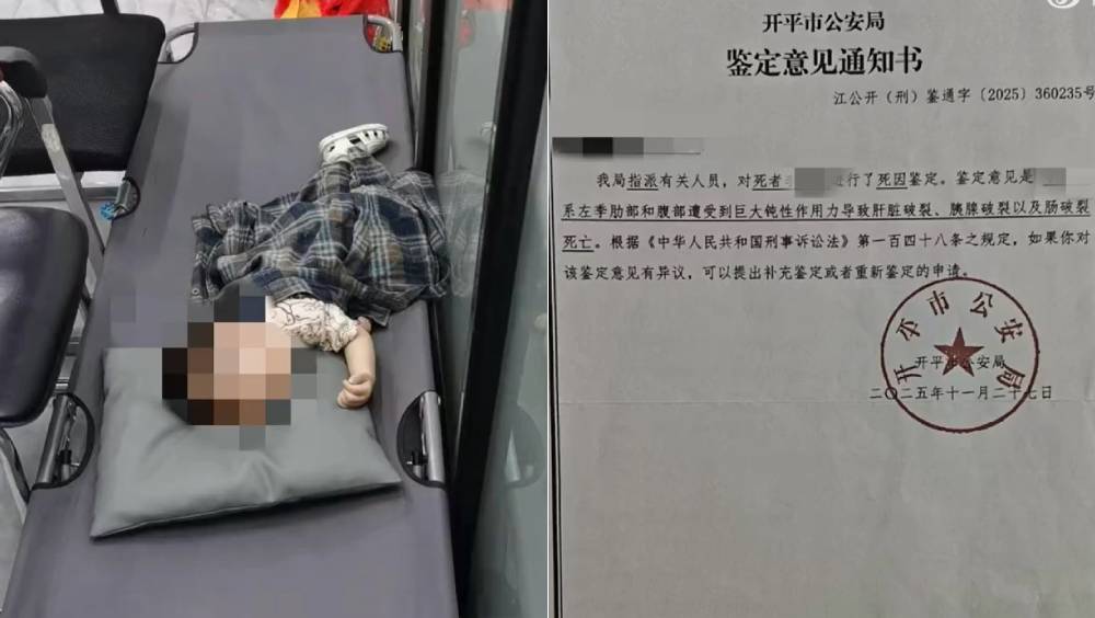 廣東1歲半男童遭生父女友踢了三次，公安鑒定內臟破裂致死。