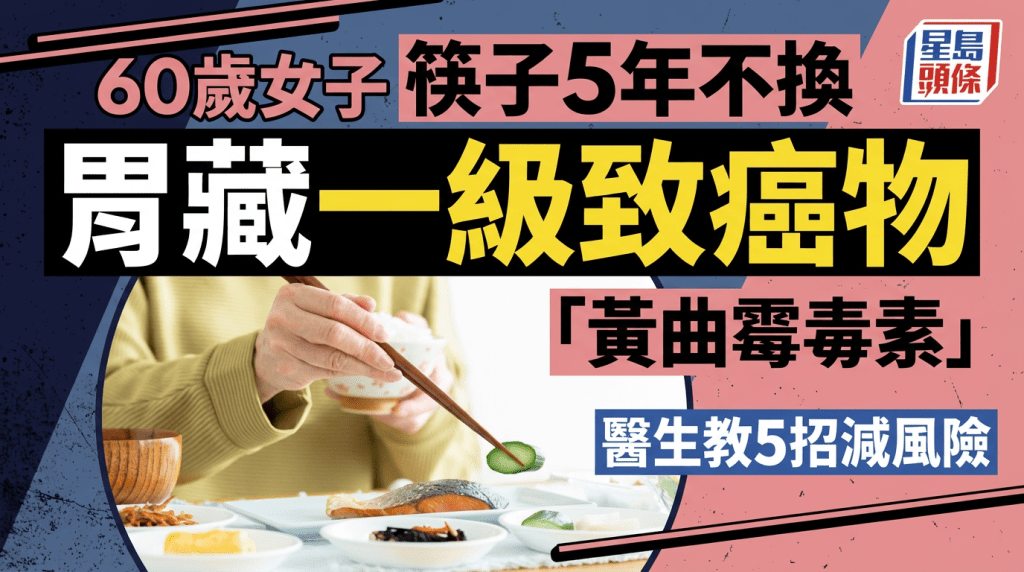 60歲女子慳家筷子5年不換 胃藏一級致癌物黃曲霉毒素 醫生教5招減風險