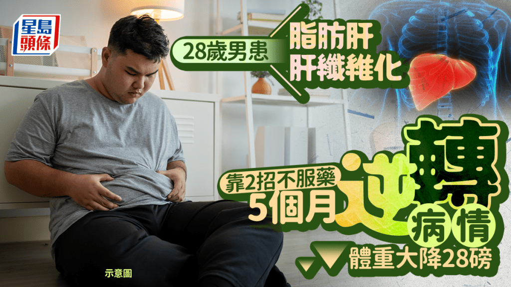 28歲男患脂肪肝/肝纖維化 靠2招5個月逆轉病情 體重大降28磅