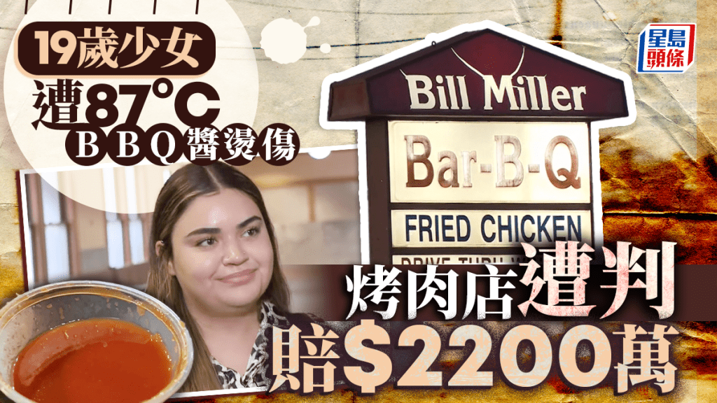 天價賠償｜19歲少女快餐店內被BBQ醬燙傷留疤  判獲賠償$2200萬