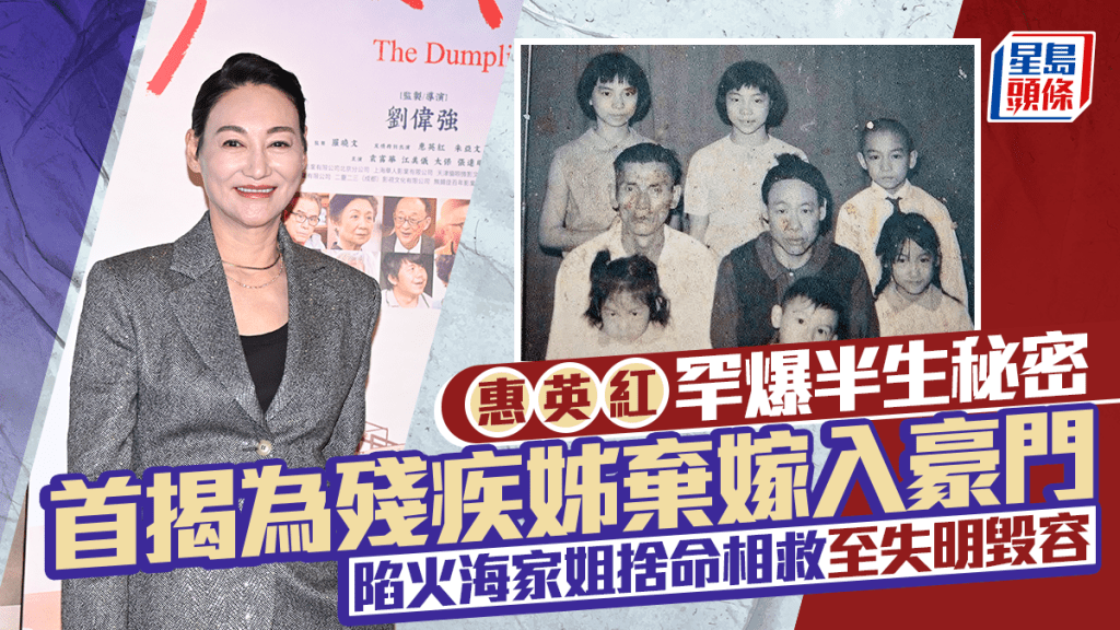 惠英紅首揭為殘疾姊棄嫁入豪門  陷火海家姐捨命相救至失明毀容  影后罕爆半生秘密