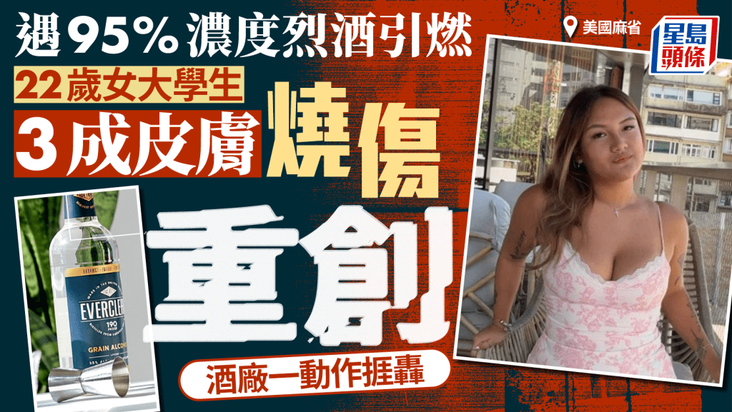 波士頓大學香港交換生遇烈酒引燃3成皮膚燒傷  酒廠被轟刪安全警告