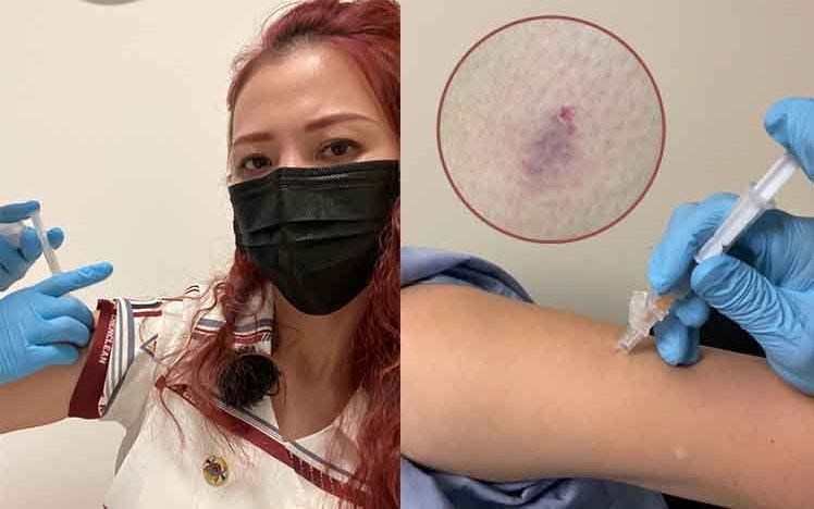 蔡少芬日前在拍攝節目途中，不慎被狗咬傷，馬上中斷拍攝到醫院打狂犬疫苗針。