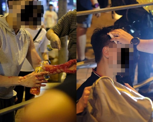 兩名男子受傷。中大學生報