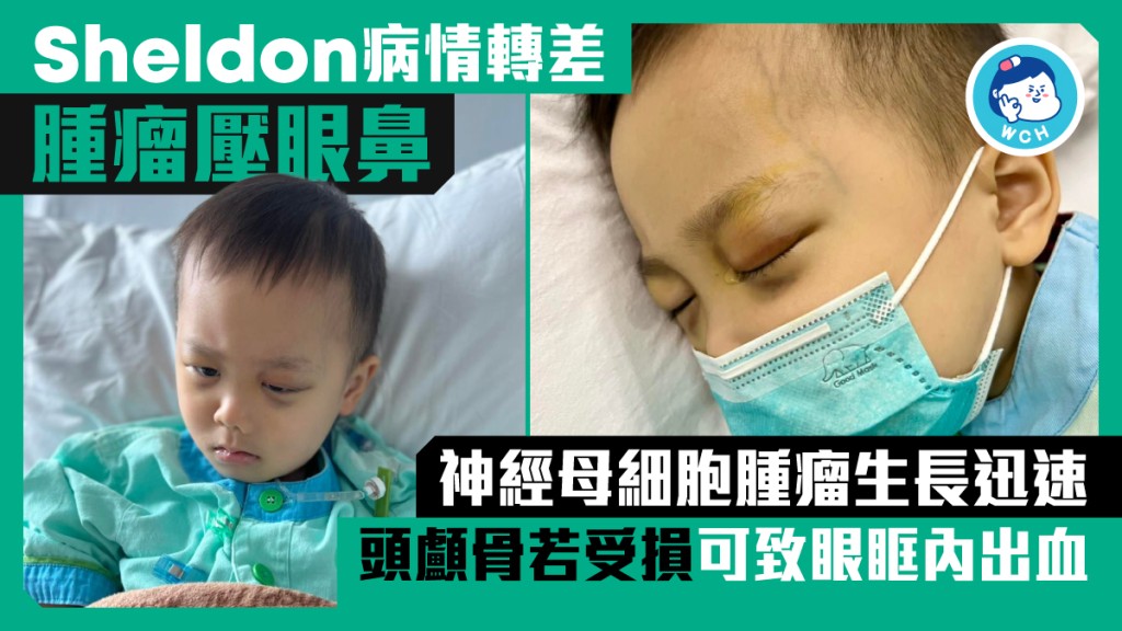 神經母細胞腫瘤生長迅速，若頭顱骨受損可致眼眶內出血。