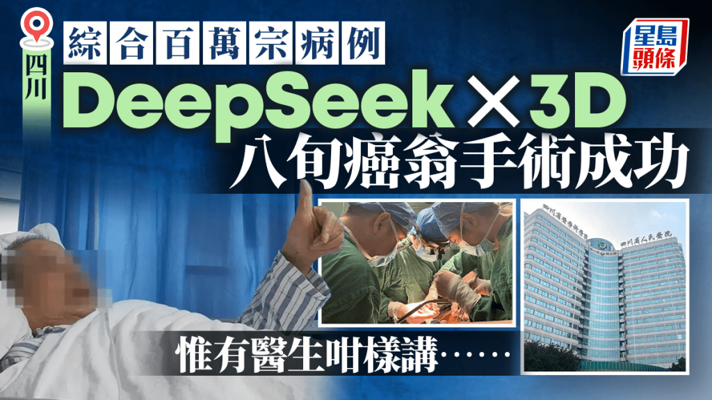 四川有泌尿科團隊利用DeepSeek設計治療方案，成功為癌患實施根治手術。紅星新聞