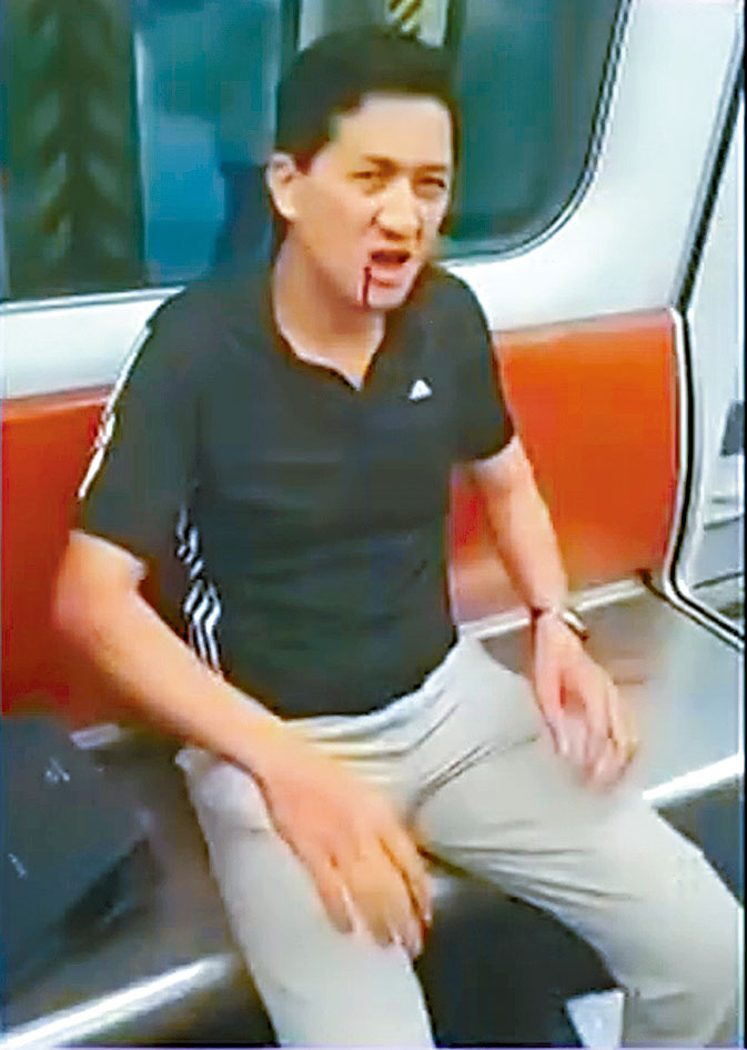 前立法會議員林卓廷當日出發到元朗站，其後遭白衣人打傷。