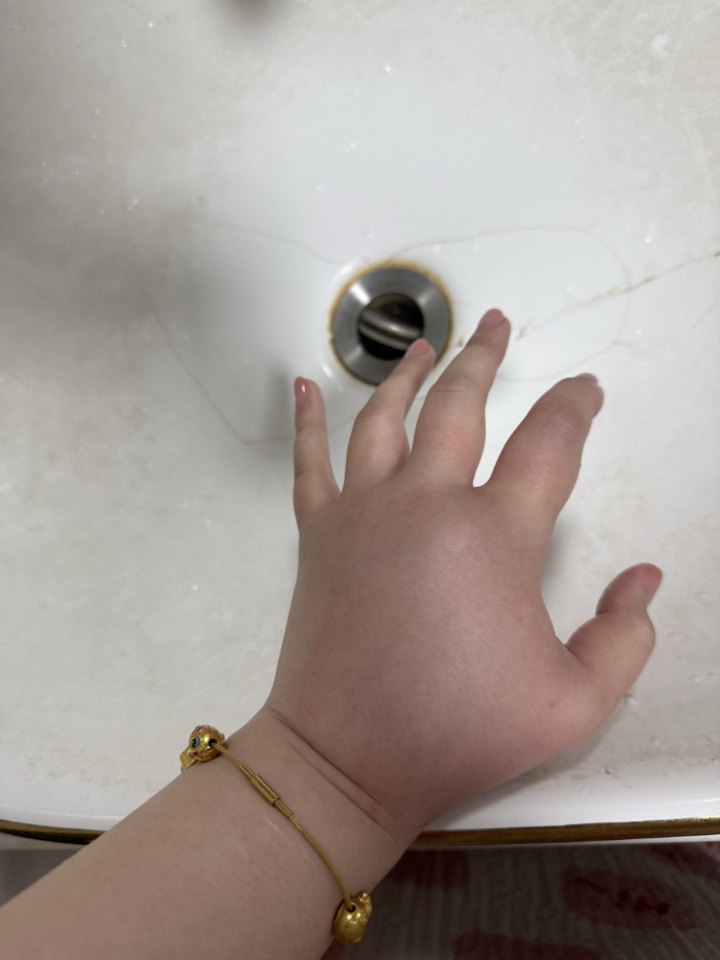 江蘇女子喂微毒的豬鼻蛇被咬，手腫如氣球。抖音