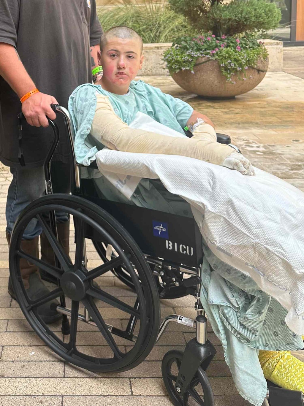 巴拉德康復期漫長。GoFundMe 巴拉德康復期漫長。GoFundMe