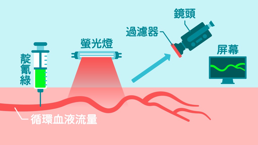 前哨淋巴測試