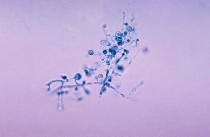 芽生菌（blastomycosis）。 CDC