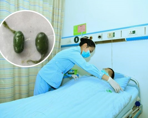 四川民眾周先生食用魚膽後中毒,需住院治理。網圖