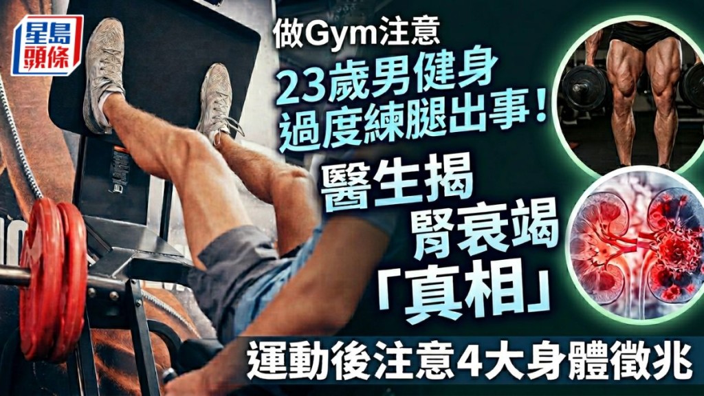 23歲男健身過度練腿出事！醫生揭引發腎衰竭「真相」運動後注意4大身體徵兆