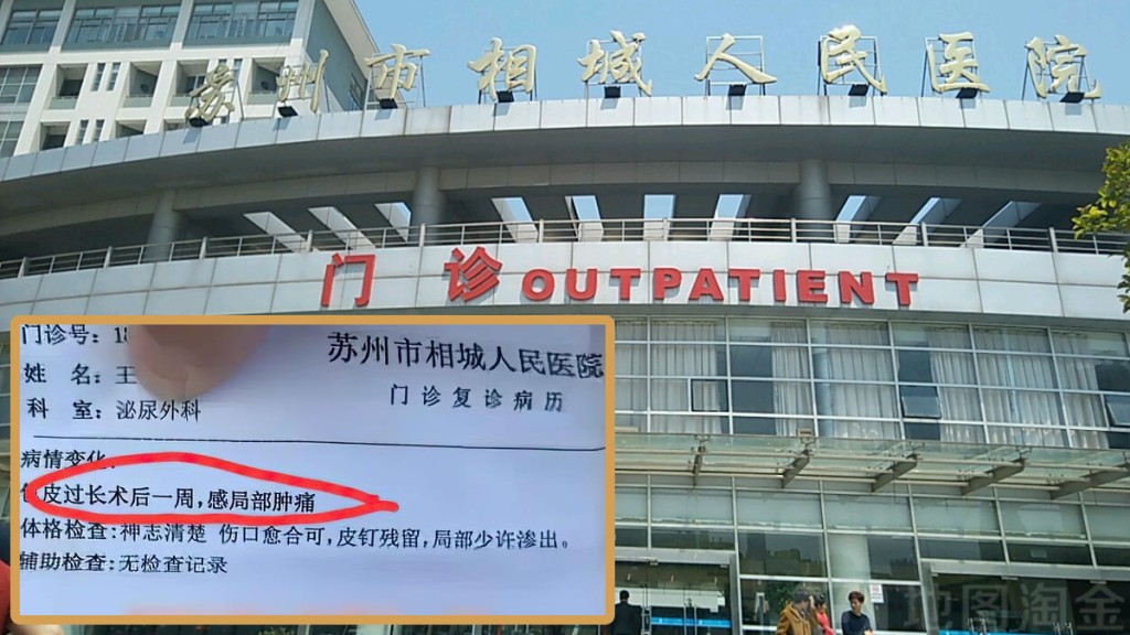 江蘇蘇州市相城人民醫院擺大烏龍，女病人竟被診斷「包皮過長」。