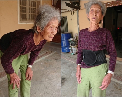 婆婆多年的駝背問題突然痊癒。網圖