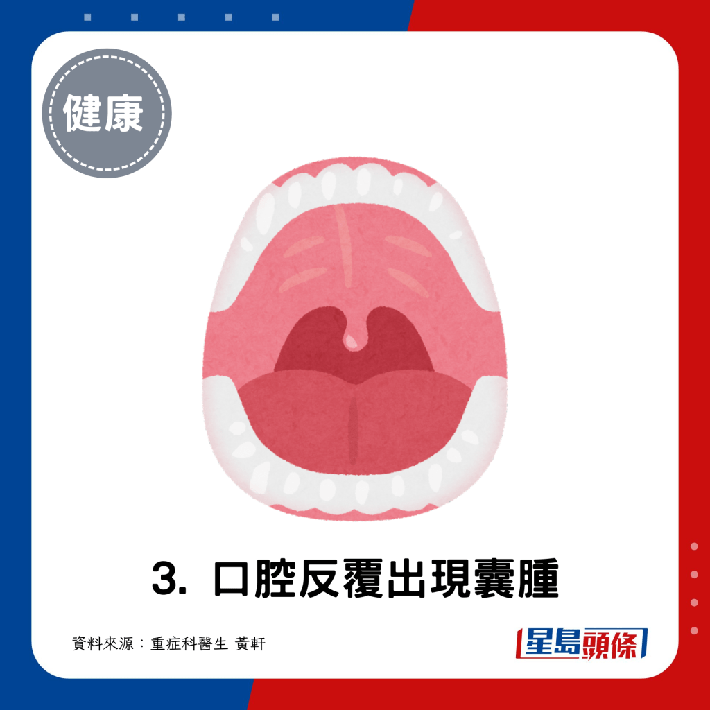 3. 口腔反覆出现囊肿