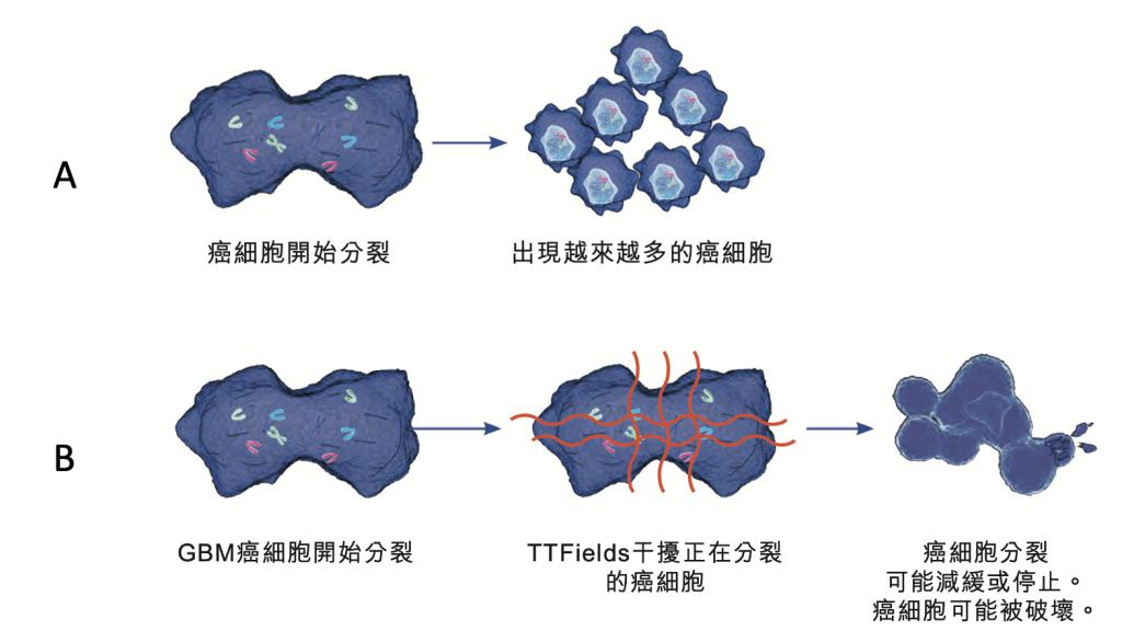  A為正常癌細胞生長過程，B為TTFields療法下GBM癌細胞的生長過程