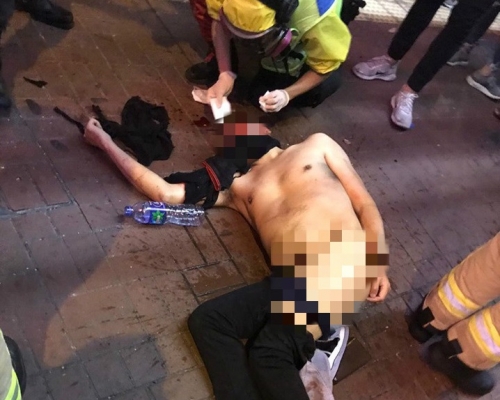 旺角男子被圍毆致私處外露。網上圖片