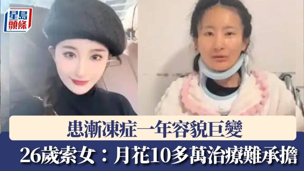 確診漸凍症一年容貌巨變，26歲索女：吞嚥都要盡全力。