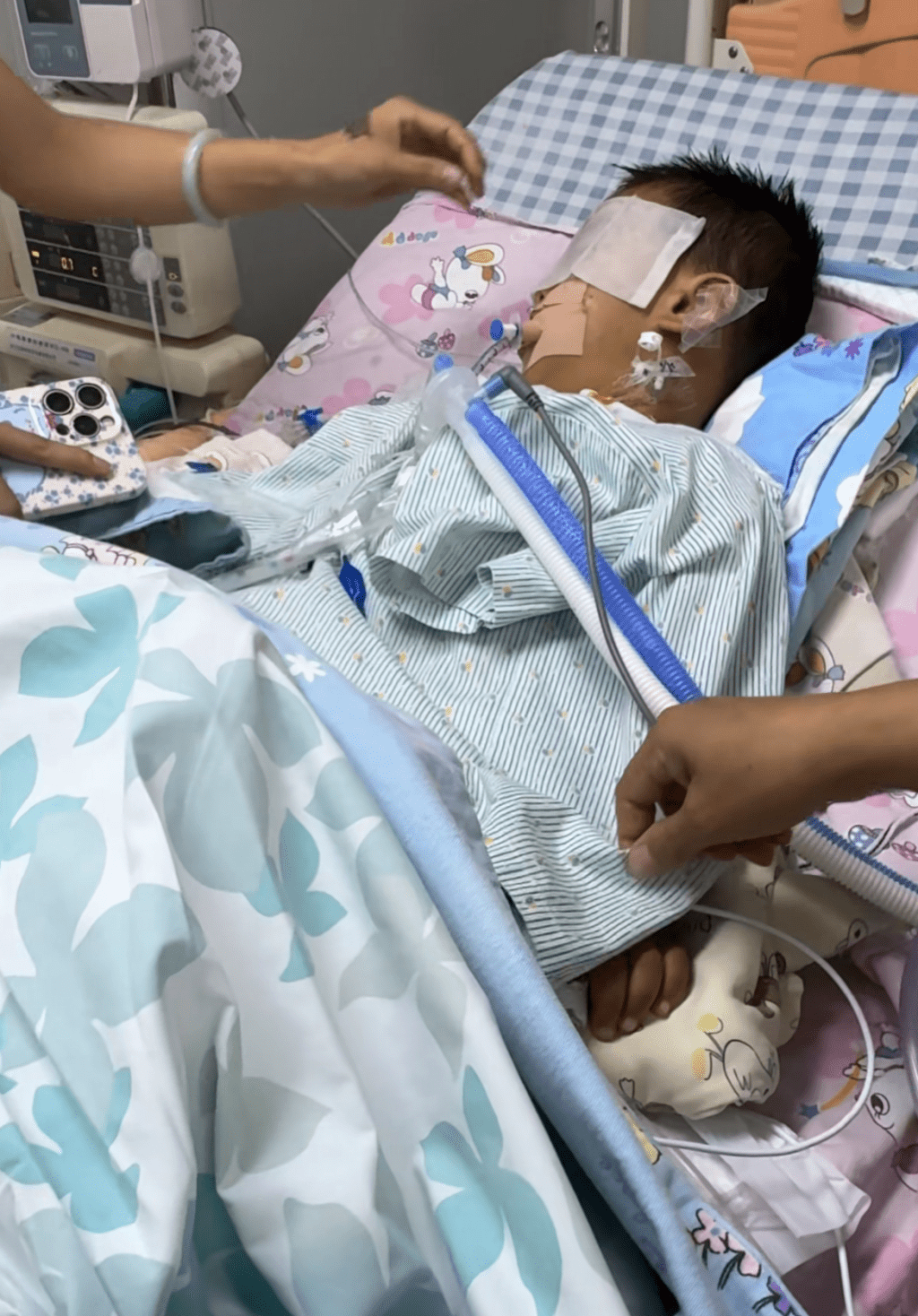  廣東3歲男童切扁桃腺術後腦死亡，意識微弱已昏迷半個月。