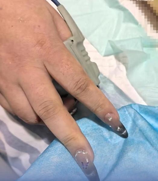 湖南女美甲太厚重，心脏病发阻碍抢救。