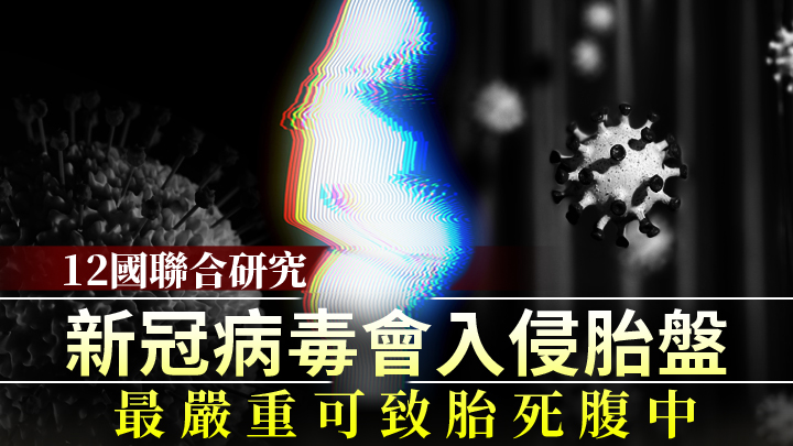 unsplash圖片