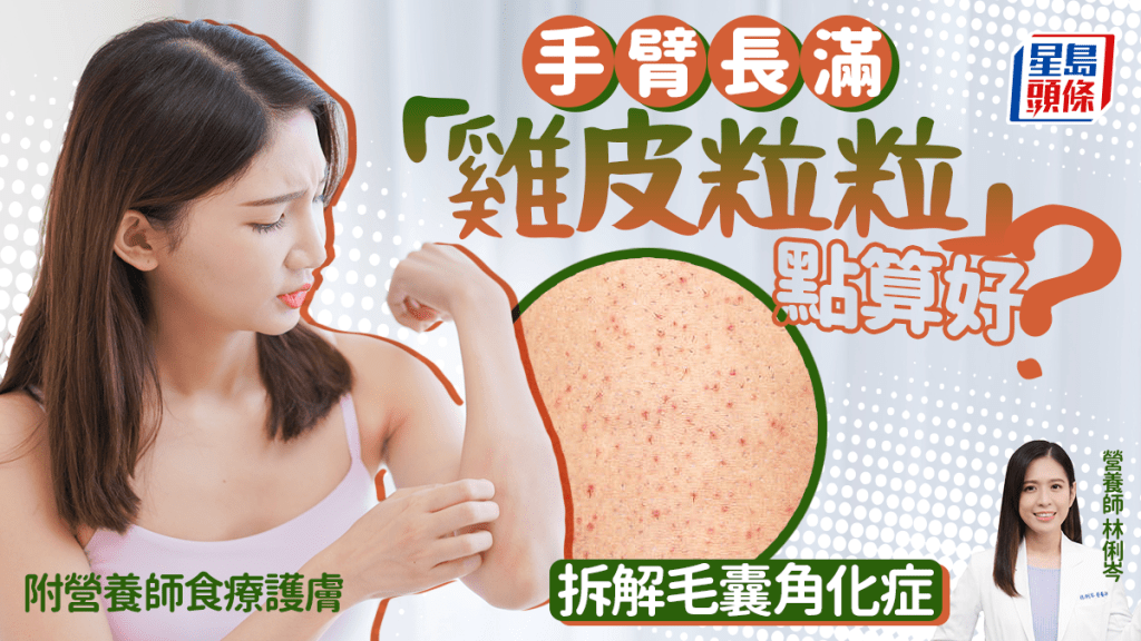 手臂生滿「雞皮粒粒」點算好？拆解毛囊角化症 營養師推菠菜食療救膚