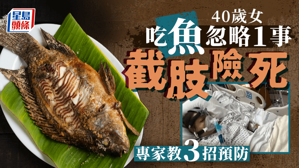40歲女吃魚忽略1事 嘴發黑截肢險死 4類海鮮風險高