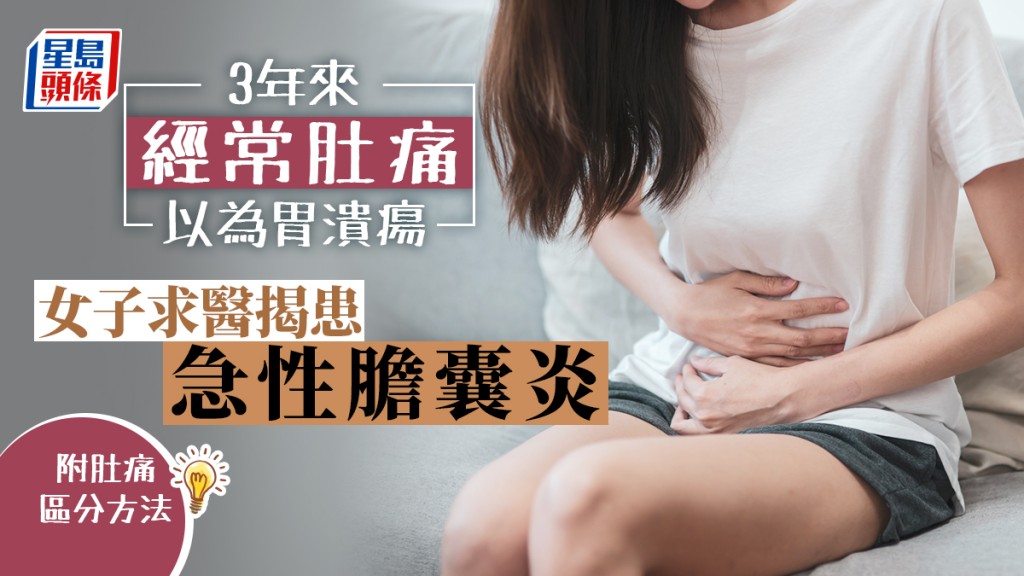 台灣一名55歲女患者肚痛長達3年，一直以為是胃潰瘍，直到某一次吃完大餐後腹部再次劇痛，求醫才證實患上急性膽囊炎。