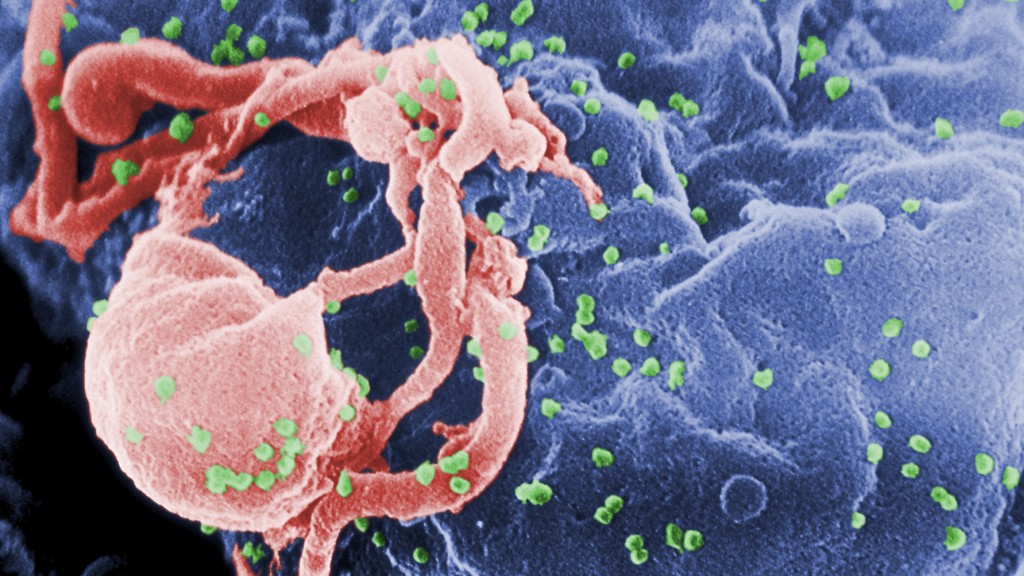 美国疾控中心取得的电子显微镜影像显示，大量HIV-1病毒体（图中球状物）从培养的人类淋巴球中发芽。 路透社