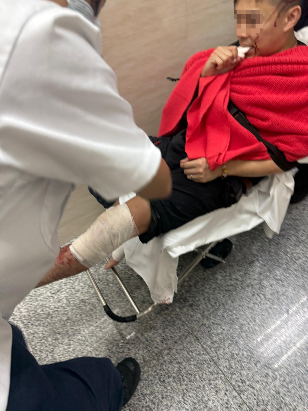 有關員左腳受傷流血。九龍城區議員利哲宏提供 有關員左腳受傷流血。九龍城區議員利哲宏提供