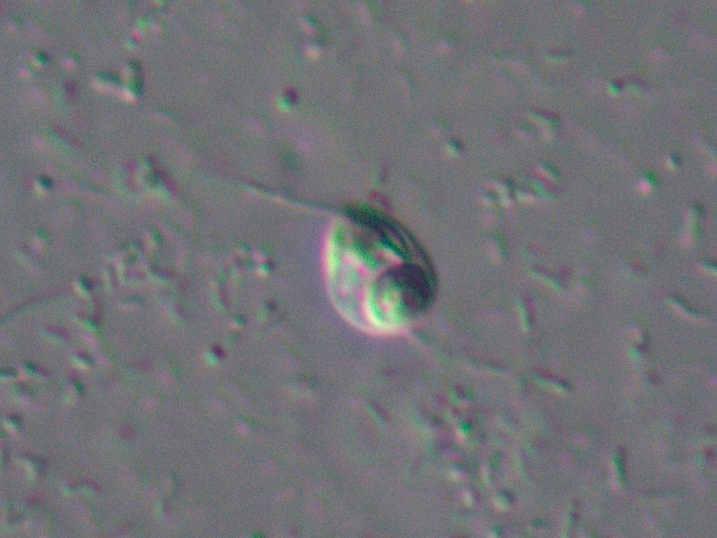 Ancoracysta twista
