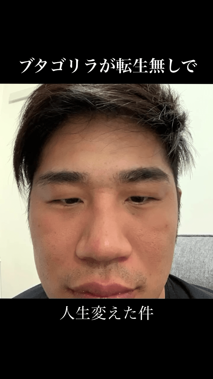 日丑男被骂“猪狒狒”饱受欺凌,狂操肌兼整容逆袭成“神户型男”。 日丑男被骂“猪狒狒”饱受欺凌,狂操肌兼整容逆袭成“神户型男”。