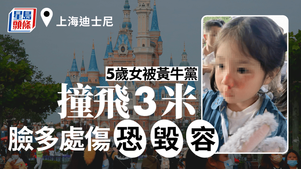 5歲女童在上海迪士尼排隊被插隊黃牛撞飛，造成臉部大面積挫傷。網圖