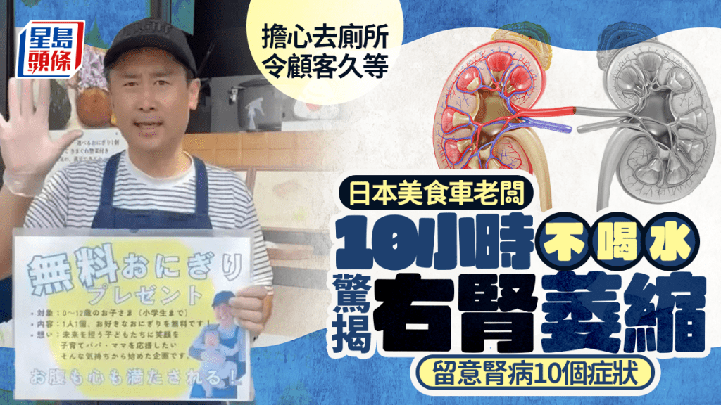 日本美食車老闆10小時不喝水 擔心去廁所令顧客久等 驚揭右腎萎 留意初期腎病10個症狀