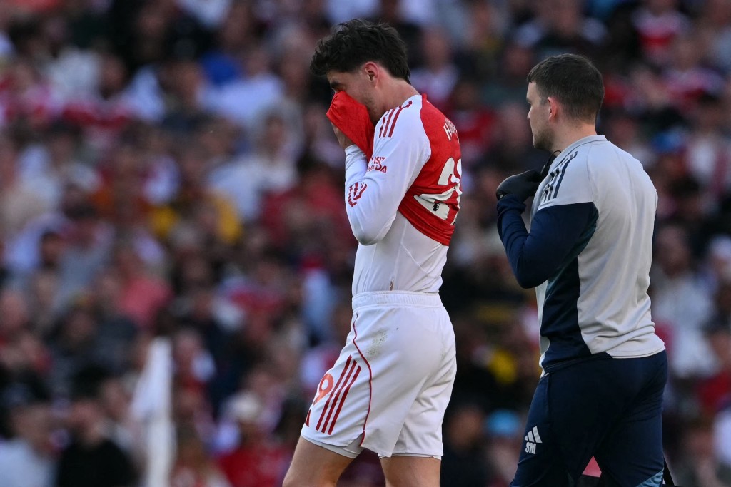 夏维斯于击败纽卡素一役伤出。法新社