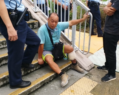 男工人左腳被燒傷。