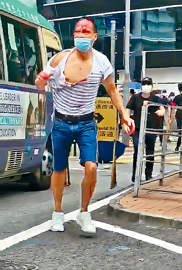 被暴打及險被刺穿頸大動脈的律師陳子遷，據知仍留醫。