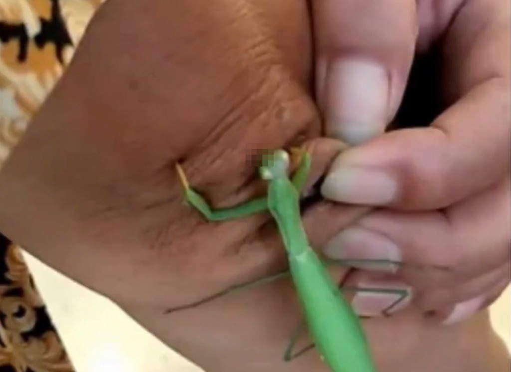 医生警告，用螳螂来食颈疣有感染风险。影片截图