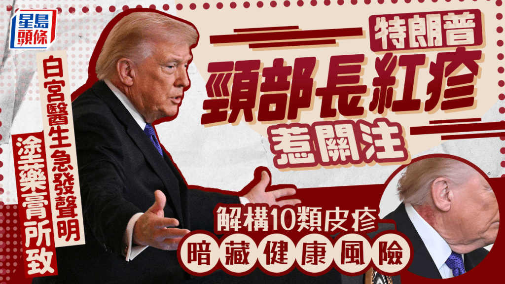 79岁特朗普颈部长红疹惹关注 白宫医生急发声明涂药膏所致 解构10类皮疹暗藏健康风险