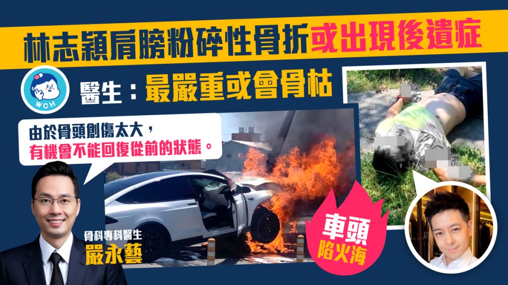 林志穎遇嚴重車禍，據悉肩膀粉碎性骨折，骨科專科醫生講解手術後有機會出現的後遺症。