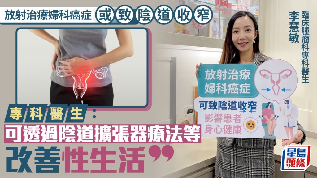 放射治療婦科癌症或致陰道收窄 專科醫生 : 可透過陰道擴張器療法等改善性生活。
